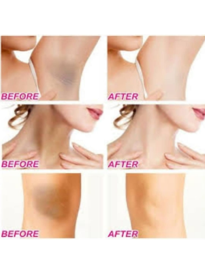 Imagen de Crema Aclarante Natural Para Axilas y Áreas Sensibles