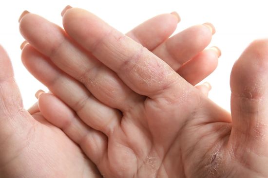 Imagen de Crema Humectante para Diabéticos