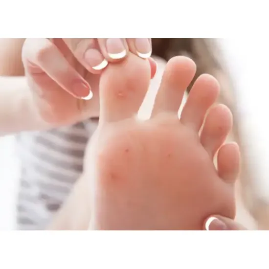 Imagen de Solución Removedora de Callos